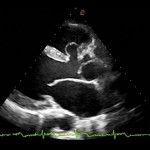 mlAlpha_Heart_XView_&_TEI_Imaging_Cardiac